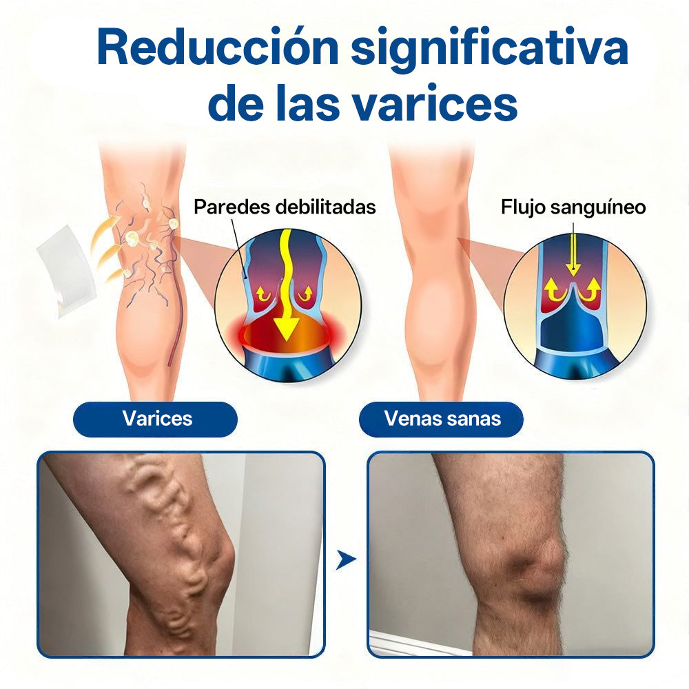 Tainun® VeinTarget Parche de Microagujas Herbal para las Venas 🌿 El primer parche de microagujas con hierbas alpinas certificado por la Unión Europea 🇪🇺 Clínicamente probado con una tasa de éxito de hasta el 96% 📊 Resultados visibles en 7–14 días 🔥