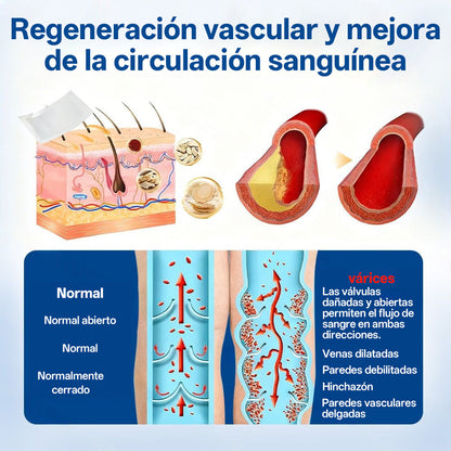 Tainun® VeinTarget Parche de Microagujas Herbal para las Venas 🌿 El primer parche de microagujas con hierbas alpinas certificado por la Unión Europea 🇪🇺 Clínicamente probado con una tasa de éxito de hasta el 96% 📊 Resultados visibles en 7–14 días 🔥